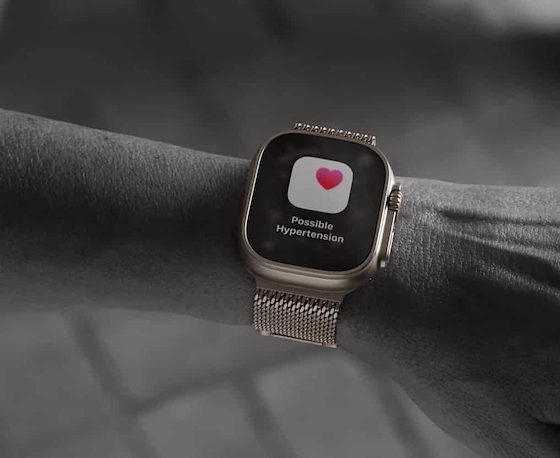 Apple Watch: Blutdruck-Funktion erhält FDA-Freigabe