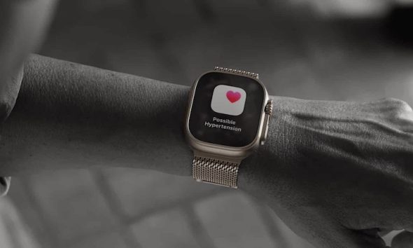 Apple Watch: Blutdruck-Funktion erhält FDA-Freigabe