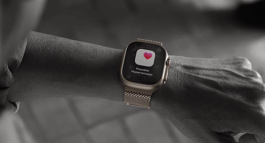 Apple Watch: Blutdruck-Funktion erhält FDA-Freigabe